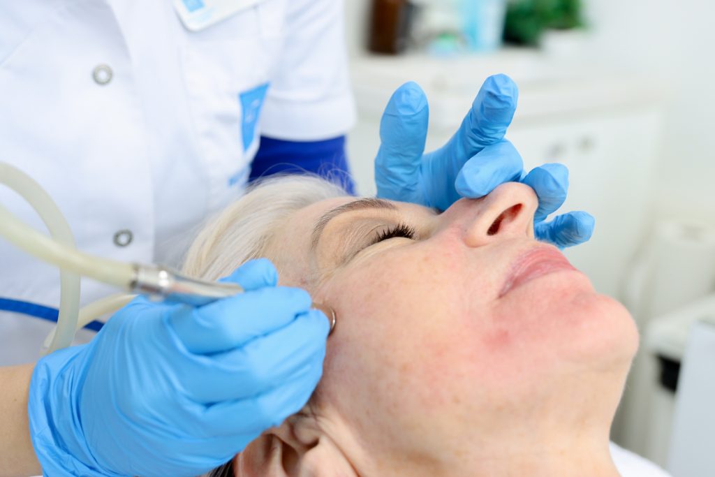 huidverbetering met microdermabrais 3