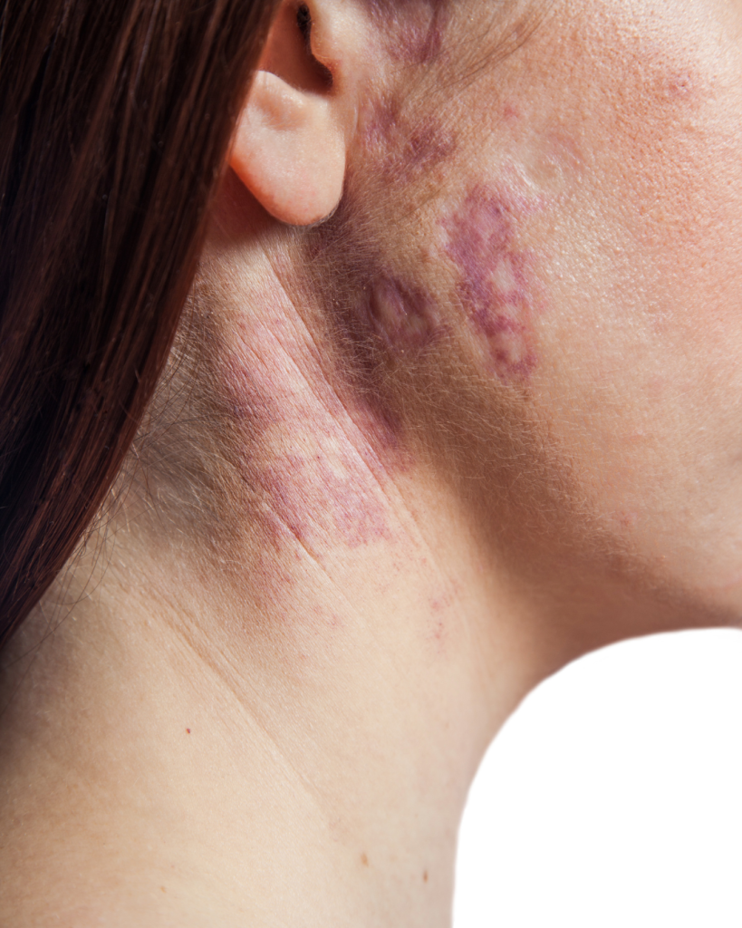 aanvullende foto's website (1)