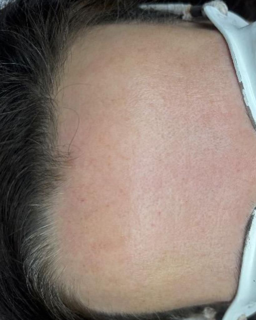 vaatlaser foto 2 (1)